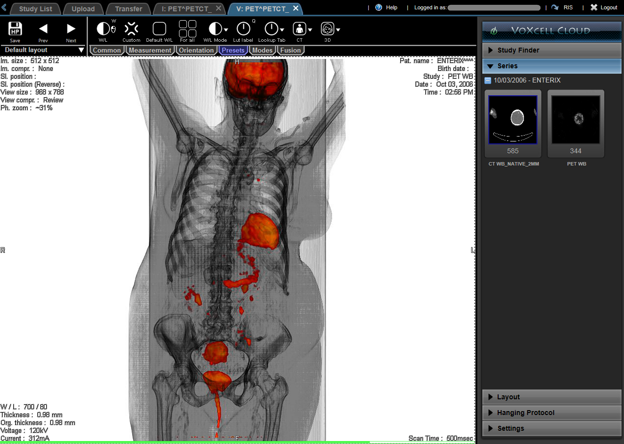 Software development outsourcing: Cloud-based system for radiologists